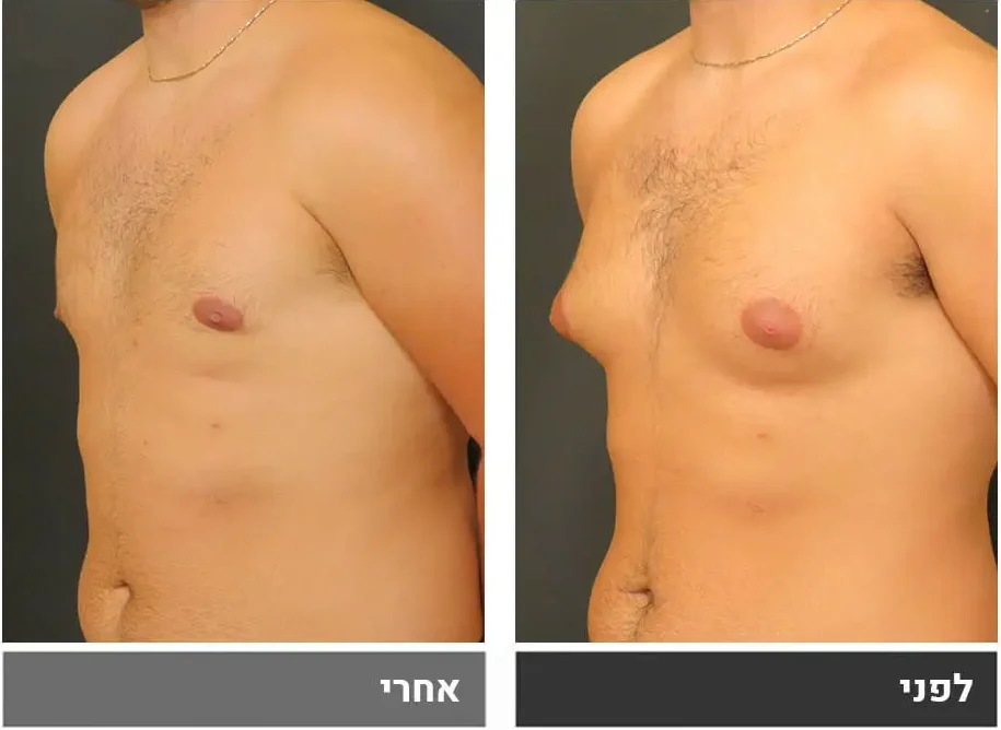 תמונת לפני/אחרי